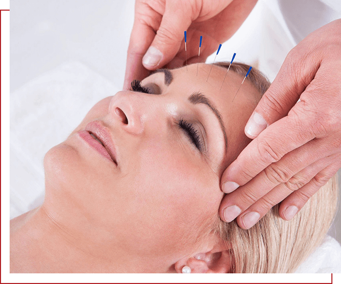 A woman getting her face waxed by an acupuncturist.